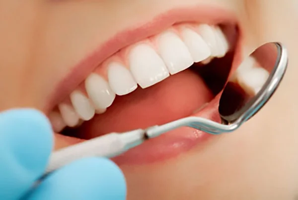 Cosmetic Dentistry